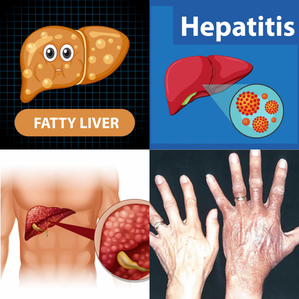Healthy Liver