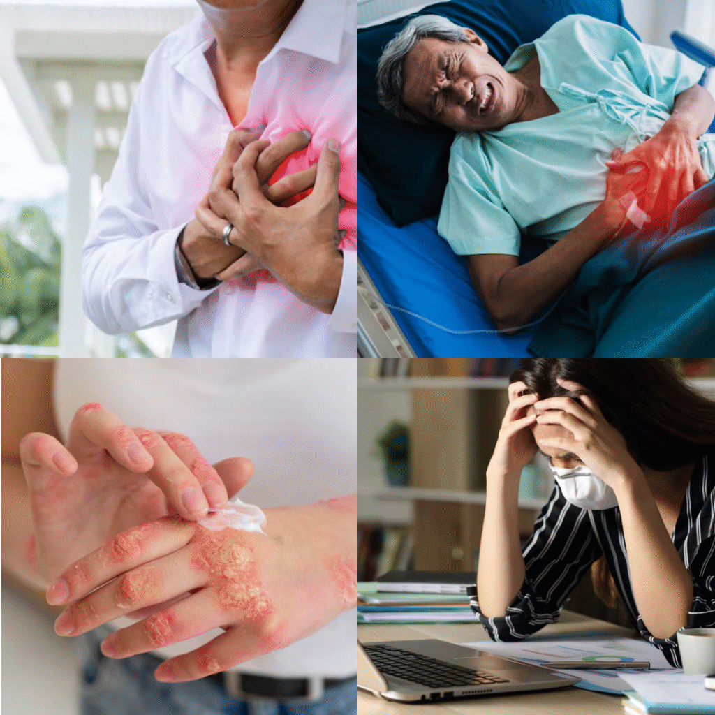 Diabetes Prevention